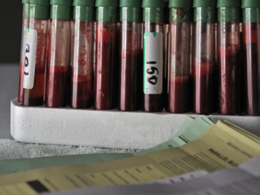 Rack of blood samples.