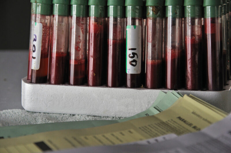 Rack of blood samples.