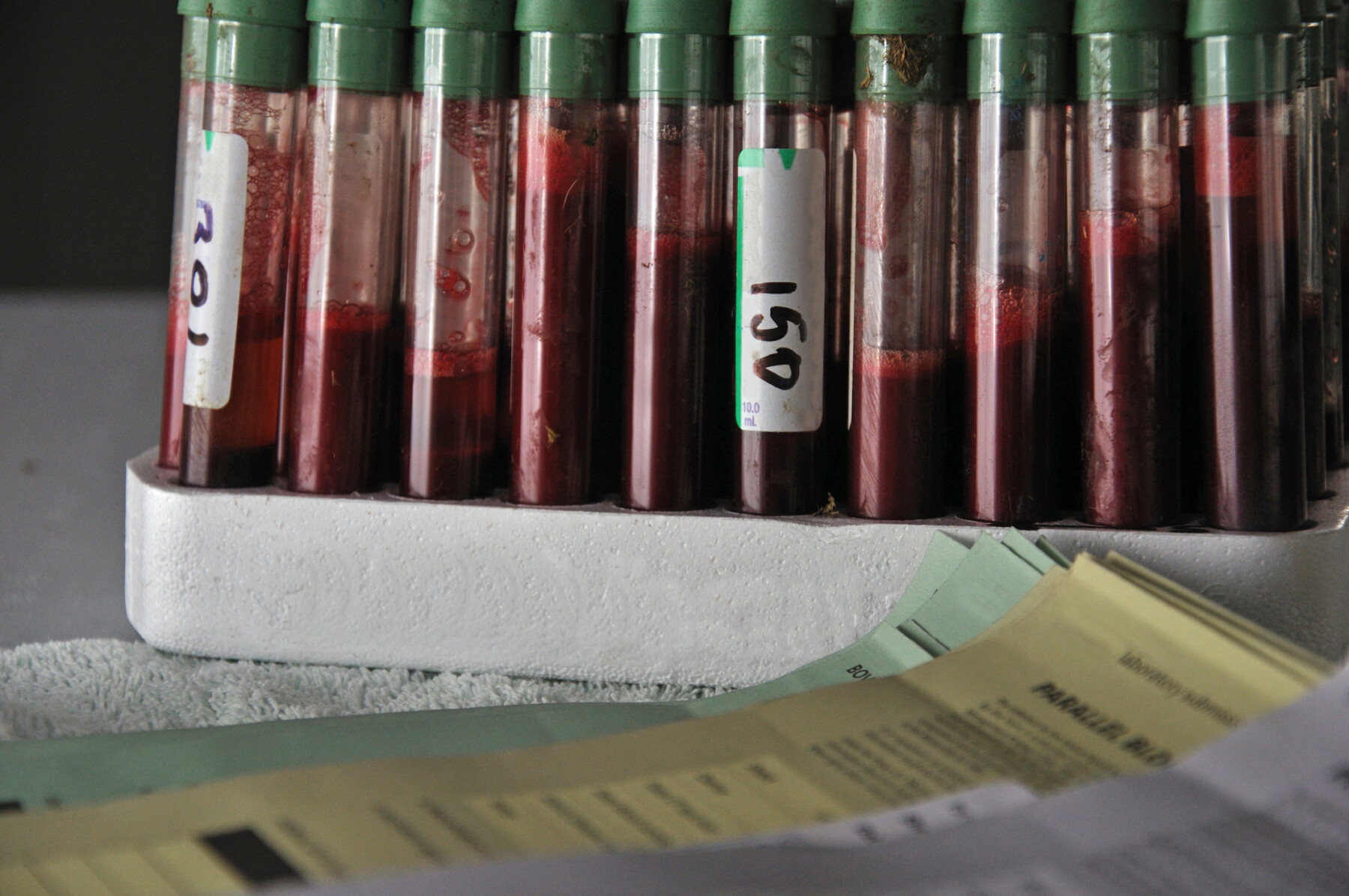 Rack of blood samples.