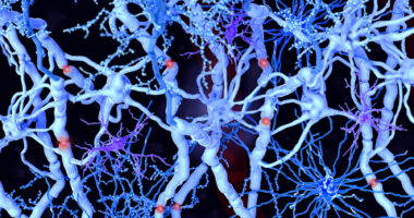 A photo shows white matter in the brain.