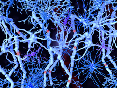 A photo shows white matter in the brain.