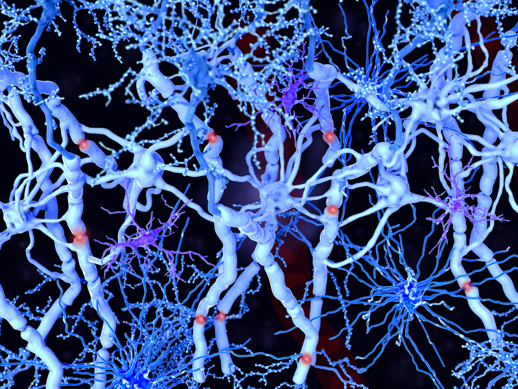 A photo shows white matter in the brain.