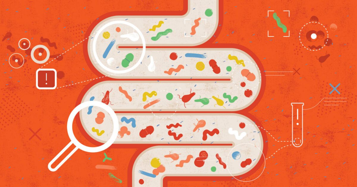 Gut bacteria may affect MS patients' response to diet interventions