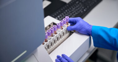 The hands of a laboratory technician are seen while performing a general blood test. The biomaterial is in special tubes.