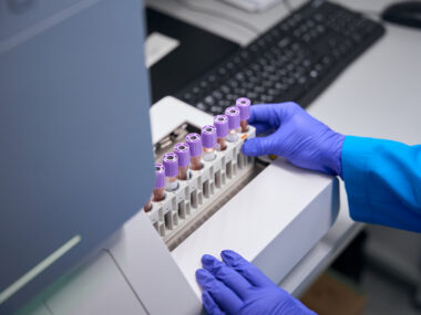 The hands of a laboratory technician are seen while performing a general blood test. The biomaterial is in special tubes.
