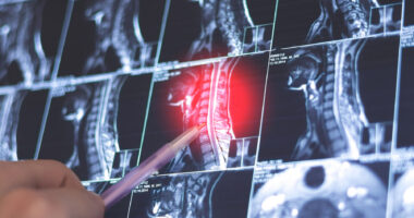 A human hand uses a small pointer to indicate an area highlighted in red on a series of imaging scans.