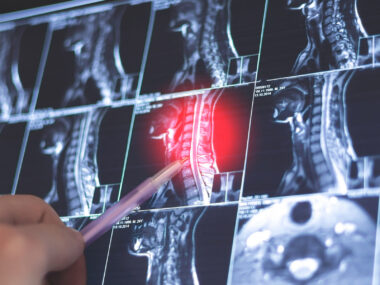 A human hand uses a small pointer to indicate an area highlighted in red on a series of imaging scans.