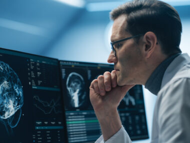 A medical professional looks at an image of a brain scan.