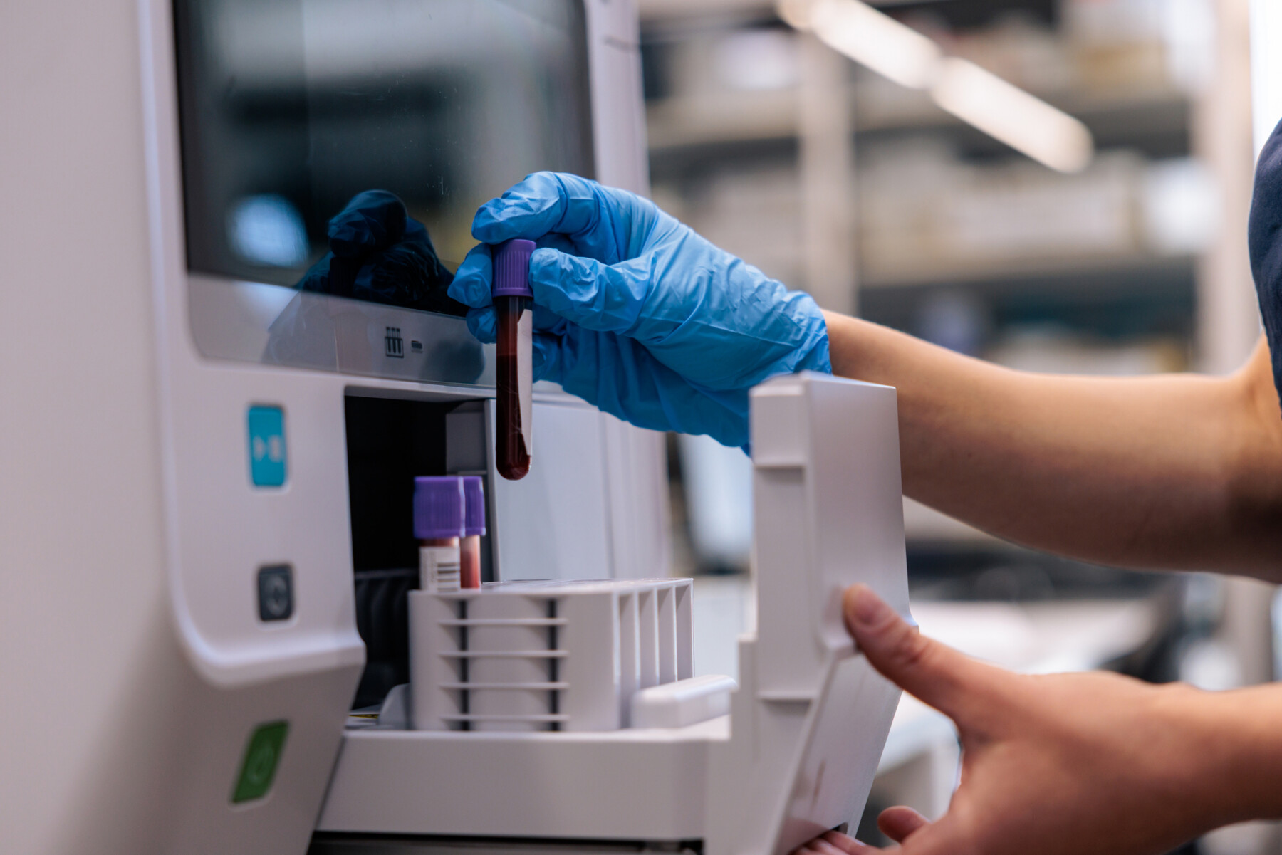 A photograph of a blood sample being processed in a lab for testing.