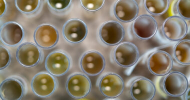 Sample collection tubes are shown in a laboratory.