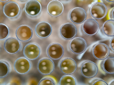 Sample collection tubes are shown in a laboratory.