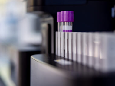 A close-up look at a blood analyzing machine at a laboratory.