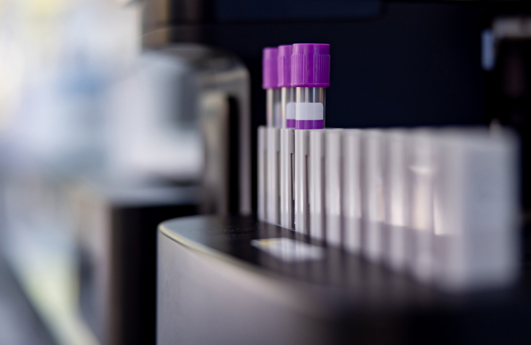A close-up look at a blood analyzing machine at a laboratory.
