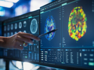 An image of a doctor pointing at a desktop computer monitor showing a scan of a patient's spinal cord.