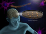 An image shows a brain organoid.