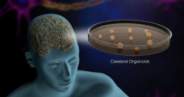 An image shows a brain organoid.