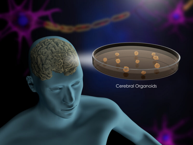 An image shows a brain organoid.