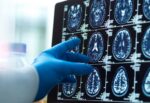 A gloved hand is seen touching brain images from an MRI scan.