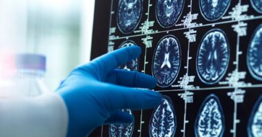 A photo shows a gloved hand touching brain images from a scan.