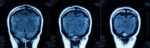 An image shows an MRI scan of a human head.