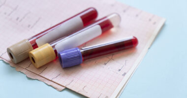 A photo shows test tubes filled with blood lying on a paper form.