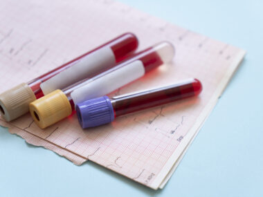 A photo shows test tubes filled with blood lying on a paper form.