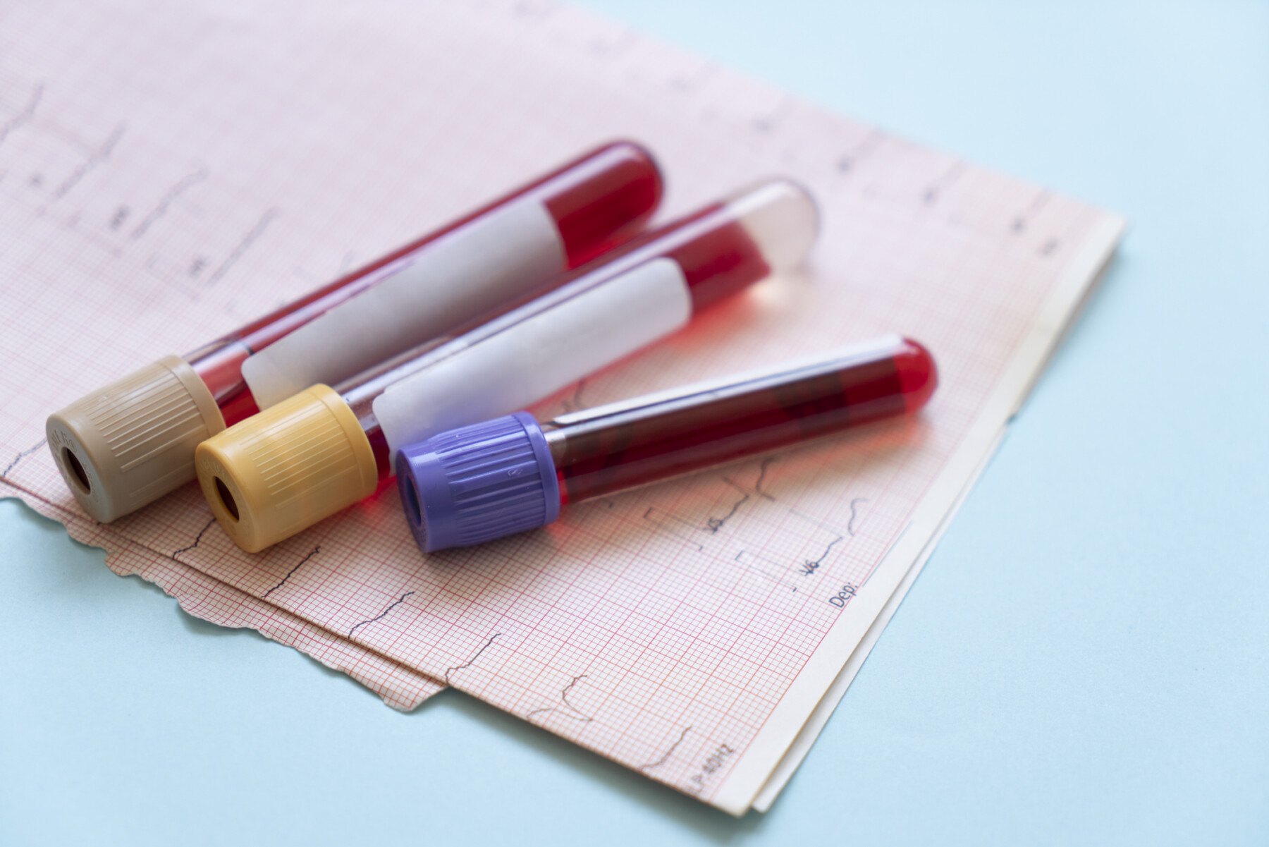 A photo shows test tubes filled with blood lying on a paper form.