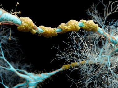 An image shows the myelin sheath surrounding nerve fibers.
