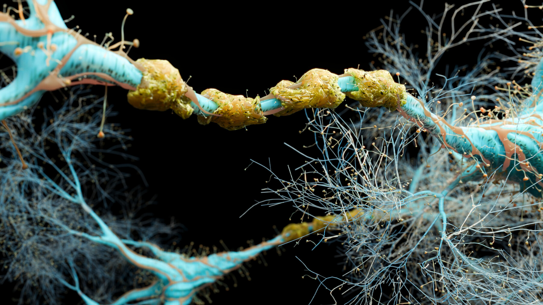An image shows the myelin sheath surrounding nerve fibers.