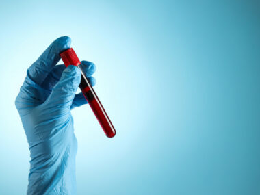 A blue-gloved hand holds a test tube filled with blood.