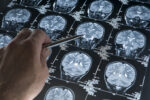 A photo shows a hand pointing at something on a brain scan.