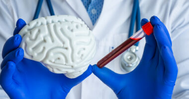 A person in a white coat with blue gloves holds a model of a brain in one hand and a blood-filled test tube in the other.