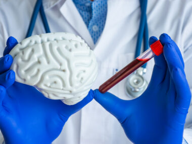 A person in a white coat with blue gloves holds a model of a brain in one hand and a blood-filled test tube in the other.