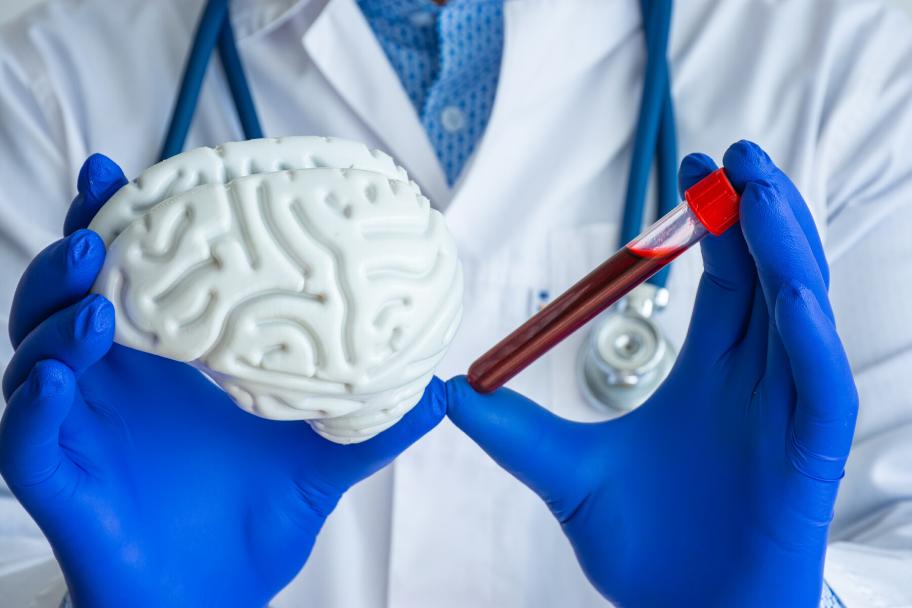A person in a white coat with blue gloves holds a model of a brain in one hand and a blood-filled test tube in the other.