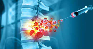 An image shows medicine being injected into a human spine.