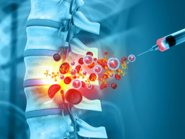 An image shows medicine being injected into a human spine.