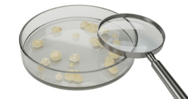 Image shows a magnifying glass resting on the rim of a petri dish that contains granules.