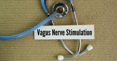 Image of a stethoscope beside a card reading “Vagus Nerve Stimulation.”